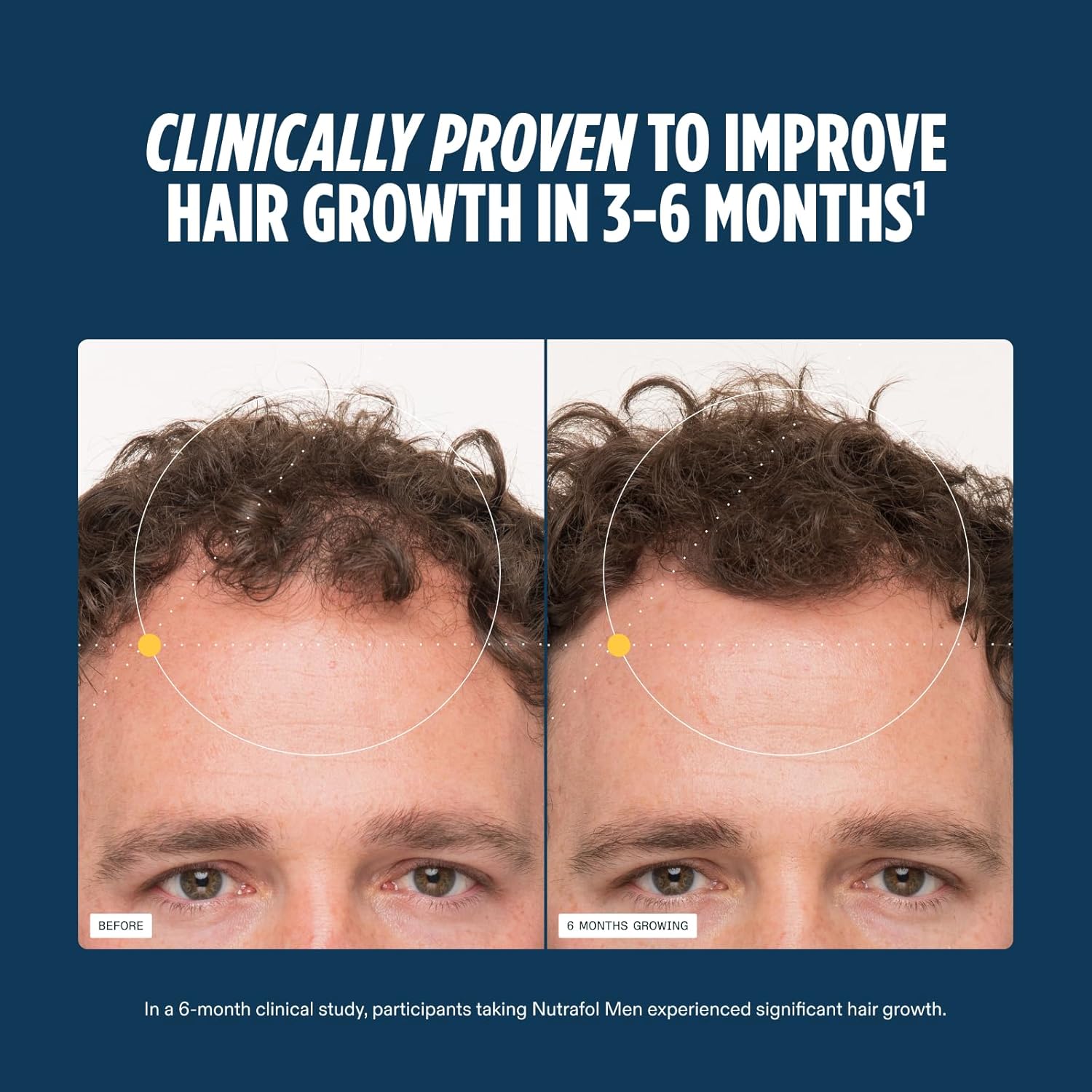 Nutrafol Men's Hair Growth Supplements, Clinically Tested for Visibly Thicker Hair and Scalp Coverage, - 1 Month Supply - Image 4